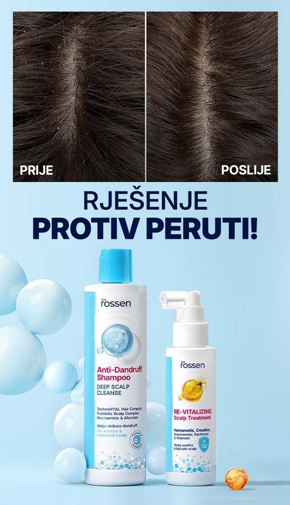 ANTI-PERUT-BANER---mali-baneri-MOB--BIH